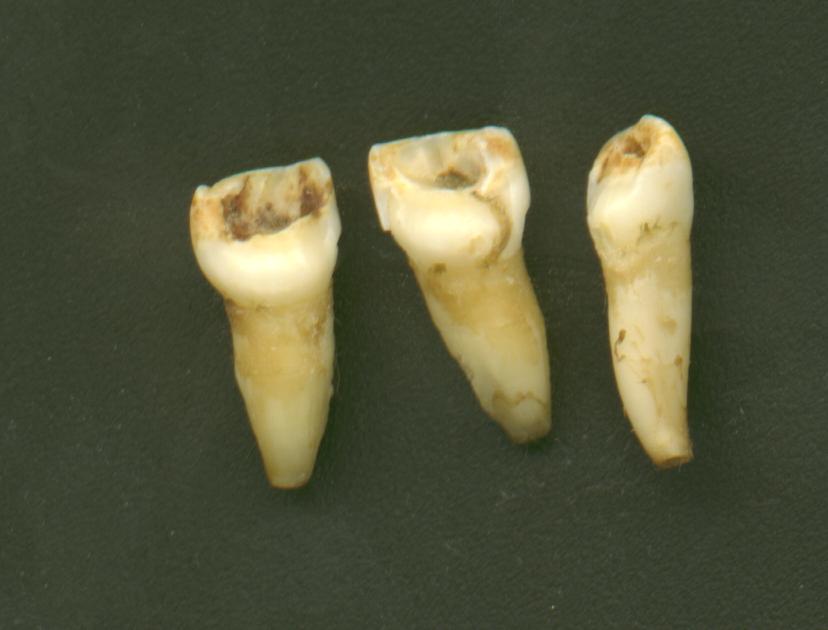 teeth.JPG (39332 bytes)